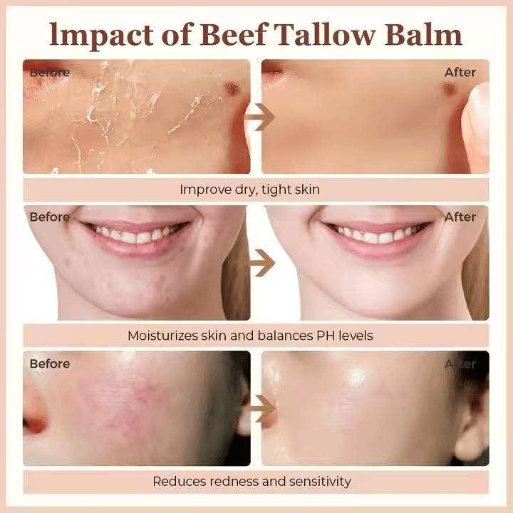 Whipped Beef Tallow Moisturizing Soothing Skincare Face Body Moisturizer Cream Balm